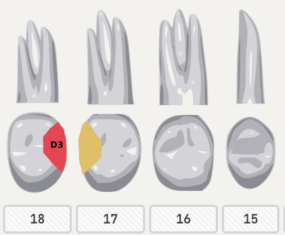 Tandstatus diagram